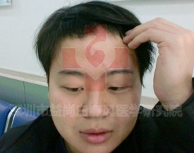 汕尾白癜风专科医院