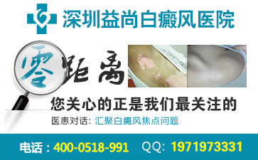 深圳女性白癜风主要患病的因素